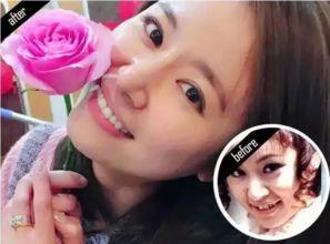 明星洗牙吗,揭秘明星洗牙的秘密