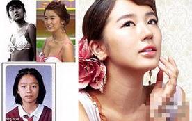 韩国整容明星对比,美丽蜕变背后的故事
