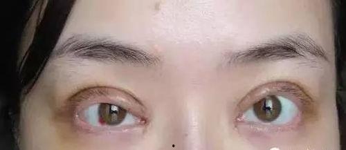 郑州双眼皮爆料案件最新